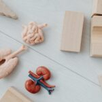 How to Prevent Kidney Stones