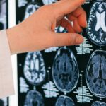 Brain Health:- Top10 Best Foods to improve for Brain Brain Health:- Top10 Best Foods to improve for Brain