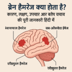 ब्रेन हैमरेज क्या होता है?