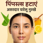 pimples : 3 दिन में पिंपल्स को कैसे हटाएं ? 100% असरदार घरेलू नुस्खे 3 दिन में पिंपल्स हटाएं – असरदार घरेलू नुस्खे