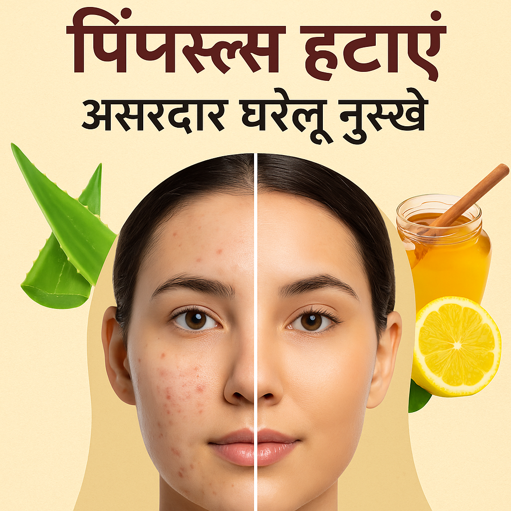 3 दिन में पिंपल्स हटाएं – असरदार घरेलू नुस्खे